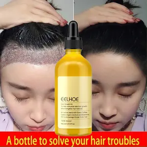 EELHOE rosmery oil untuk rambut penumbuh rambut serum penumbuh rambut hair serum rambut rontok  Hair Growth vitamin penumbuh rambut hair tonic