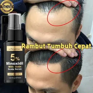 Minoxidil Penumbuh Rambut Obat Penumbuh Rambut Botak, Tipis Dan Rontok Super Cepat Ampuh Isi Anti Botak Rambut Lebat Sehat Berkilau Serum Penumbuh Rambut Cepat Hair Oil Rambut Rontok Hair Growth Serum Obat Penumbuh Rambut Botak Pria Wanita