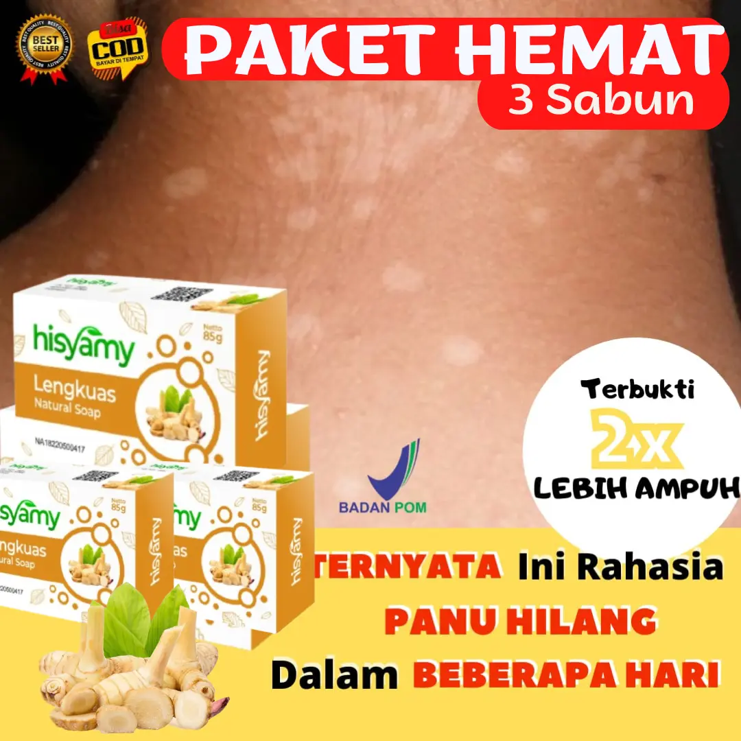 [BPOM]  LEBIH HEMAT 3 PCS Sabun Herbal Lengkuas Hisyamy Penghilang Panu Paling Ampuh Jamur Kadas Kurap Eksim Bisul Jerawat Gatal Kulit Original COD 85 gram Sabun Mandi Batang Pembersih Wajah Muka