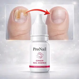 ProNail Serum Anti Baklteri Ginger Nail Essence Merawat Kuku Mengatasi Cantengan Bengkak Bernanah Menghitam Gratis Ongkir