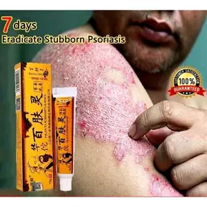 salep HUATUOBAIFULING obat herbal China penyembuh kulit gatal panu eksim kutu air kadas kurap jerawat alergi herpes ruam