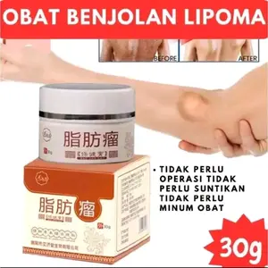 ZHI FANG LIU_ Lipoma Cream Pengurang Benjol Lemak Asli 30g Efektif & Aman Tanpa Iritasi Cocok untuk Penggunaan Sehari-hari
