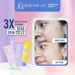 Madame Gie You Peel Me - 3 X MORE EFFECTIVE Peeling Gel To Remove Dead Skin Cells Semua Jenis Kulit Wajah