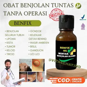 Minyak Oles Khusus Benjolan Tanpa Operasi Ampuh Alami Benfix Obat Herbal Obat Lipoma Keloid Ambeien Ambeyen Kelenjar Getah Bening Gondok Obat Benjolan Di Tubuh Leher Punggung Pantat Kepala Perawatan Esensial Perawatan Kulit